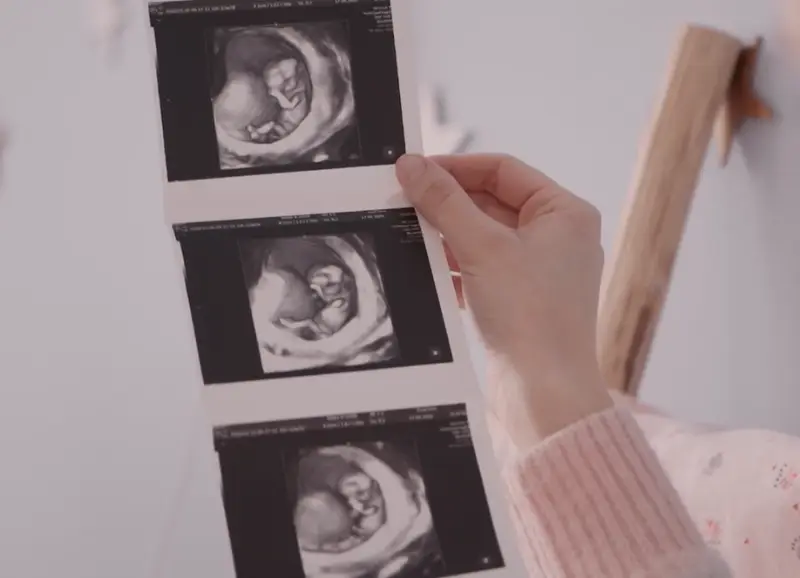 Ultrasound scanner console